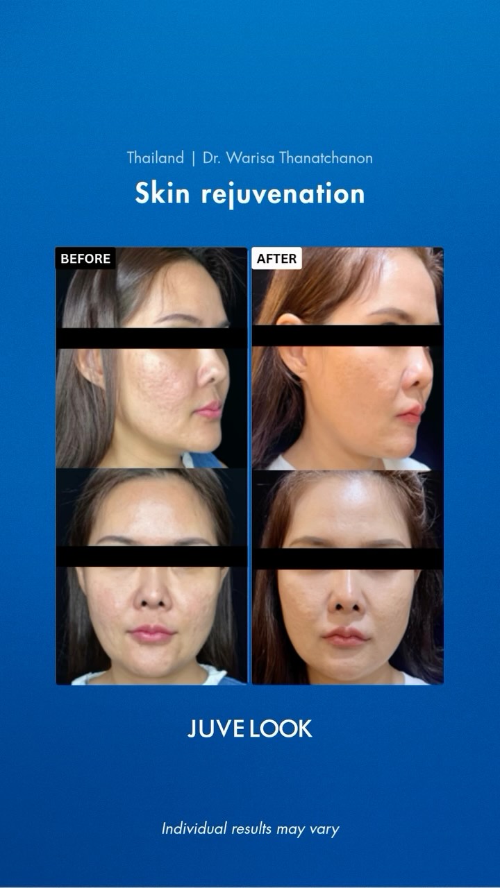 juvelook.global 品牌动态