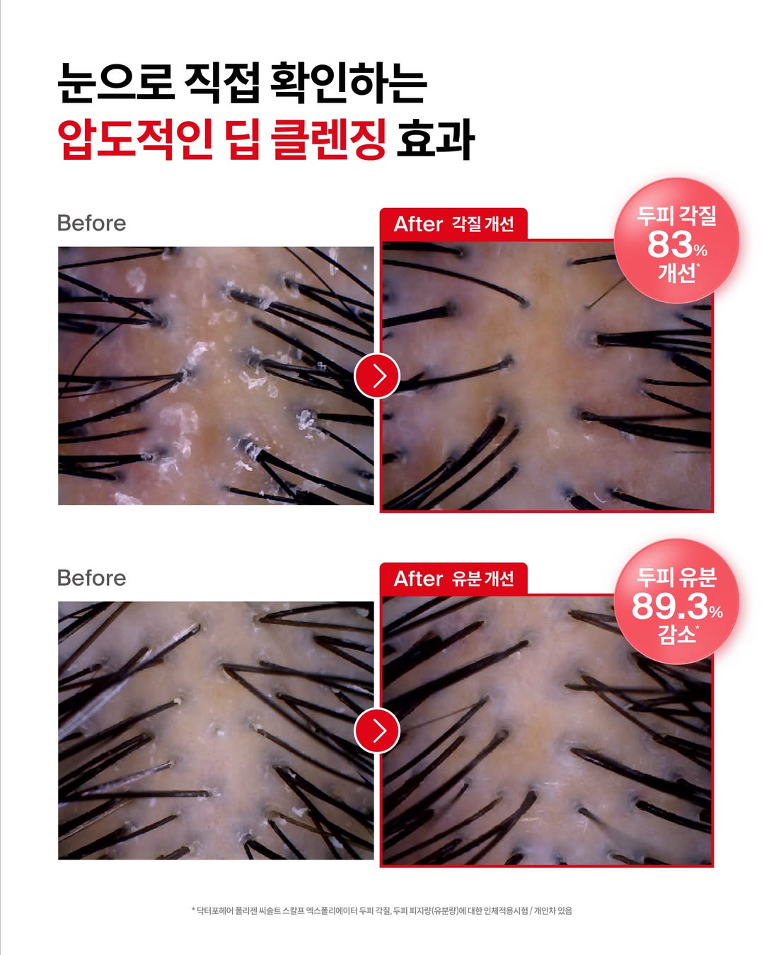 drforhair.kr 品牌动态图片