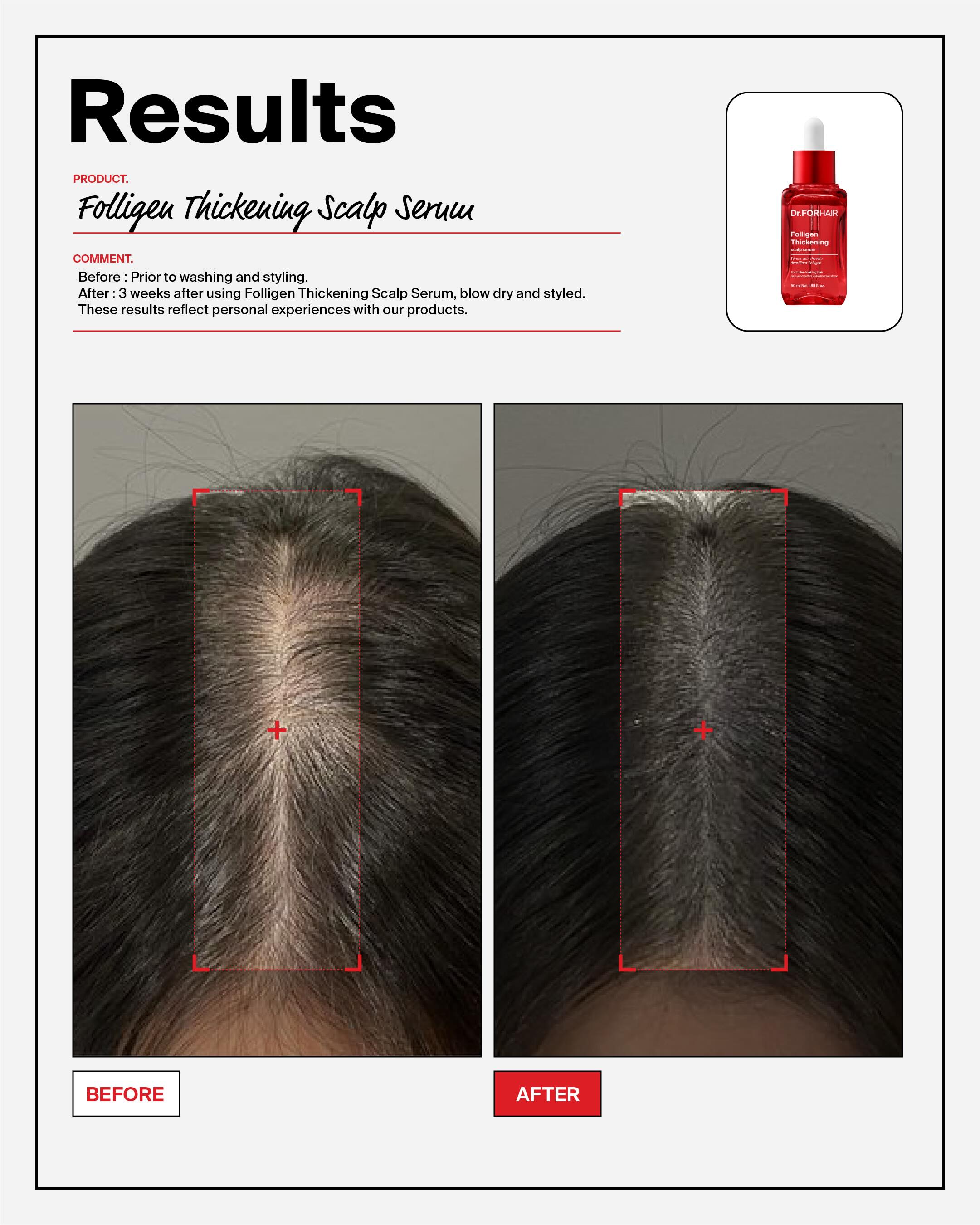 drforhair.global 品牌动态