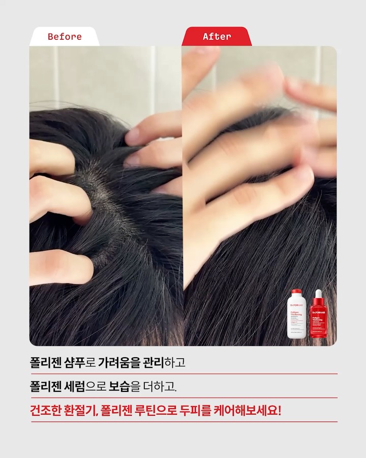 drforhair.kr 视频封面
