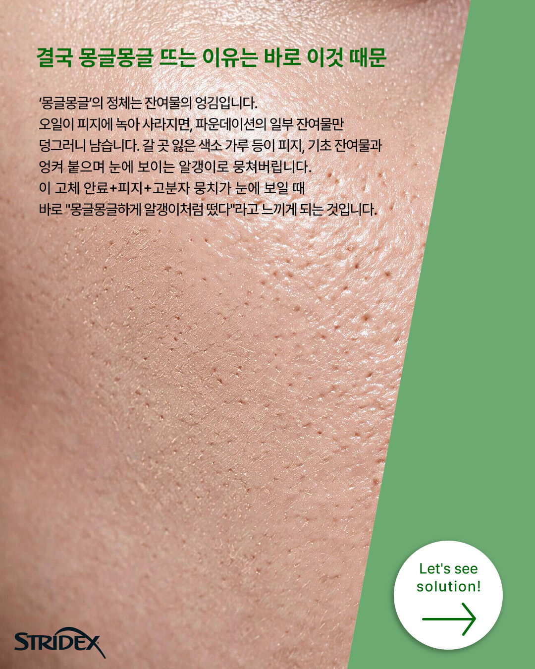 stridex_kr_official 品牌动态图片