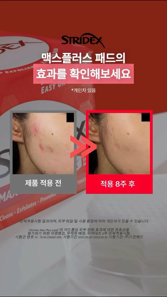 stridex_kr_official 品牌动态
